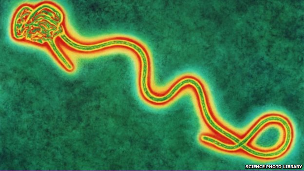 Ebola Virus Creates Intracellular Tunnels To Hide and Move in the