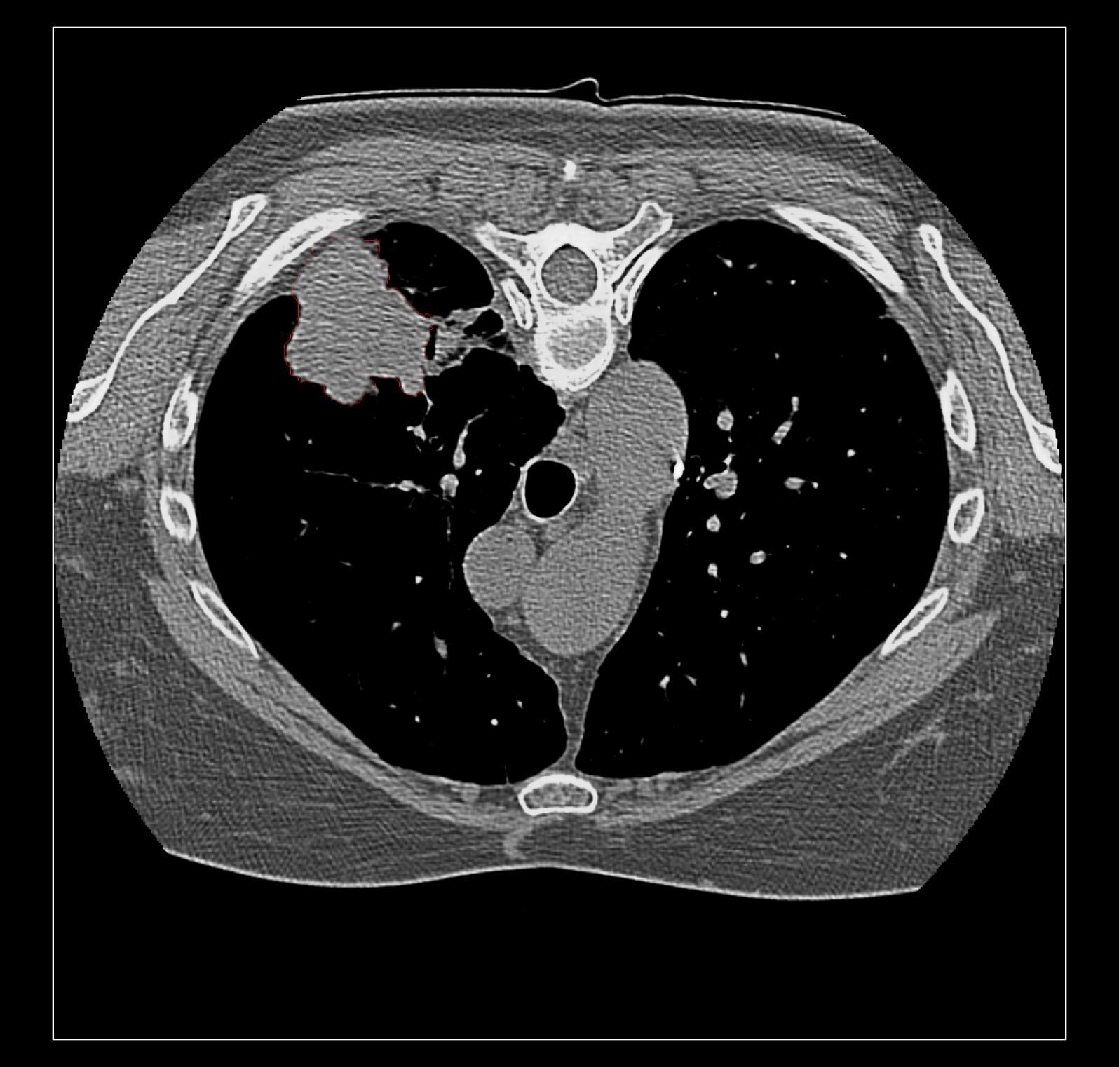 Added by email2trac Added by email2trac