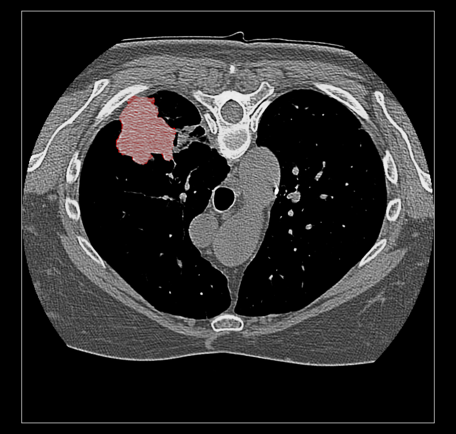 Added by email2trac Added by email2trac